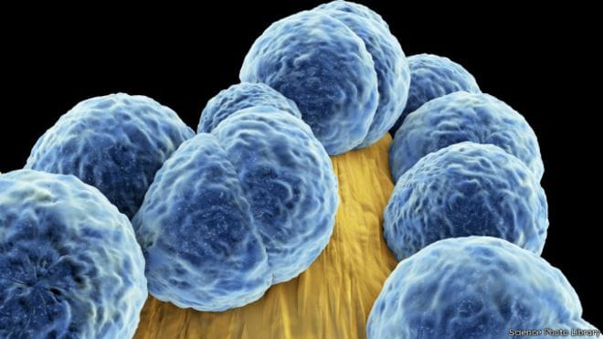 In the United States first time  dangerous superbugs