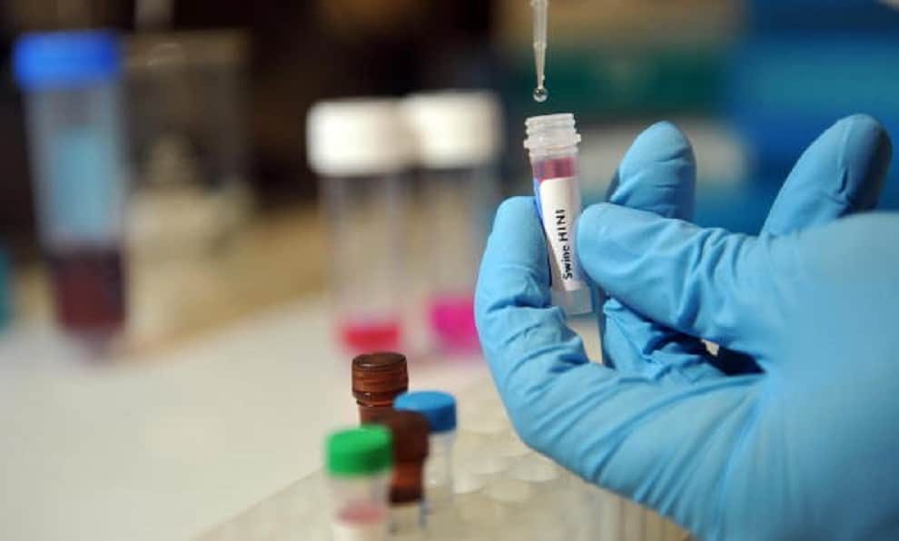 Taiwan Police Conducts Dna Test to Catch Thief Who Stole Curd