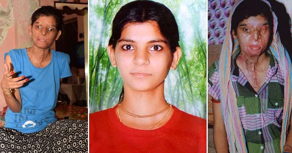 Ritu Saini: Conquering Life After Acid Attack