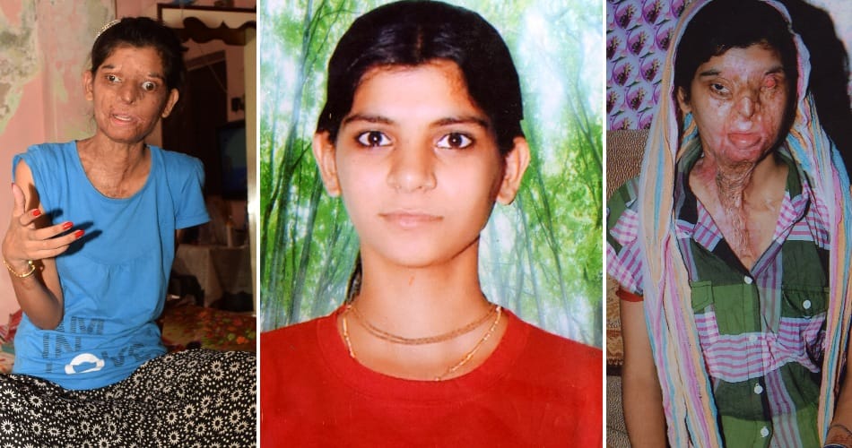 bashindey, acid attack victim ritu saini, success story, ajab gajab people, weird people
