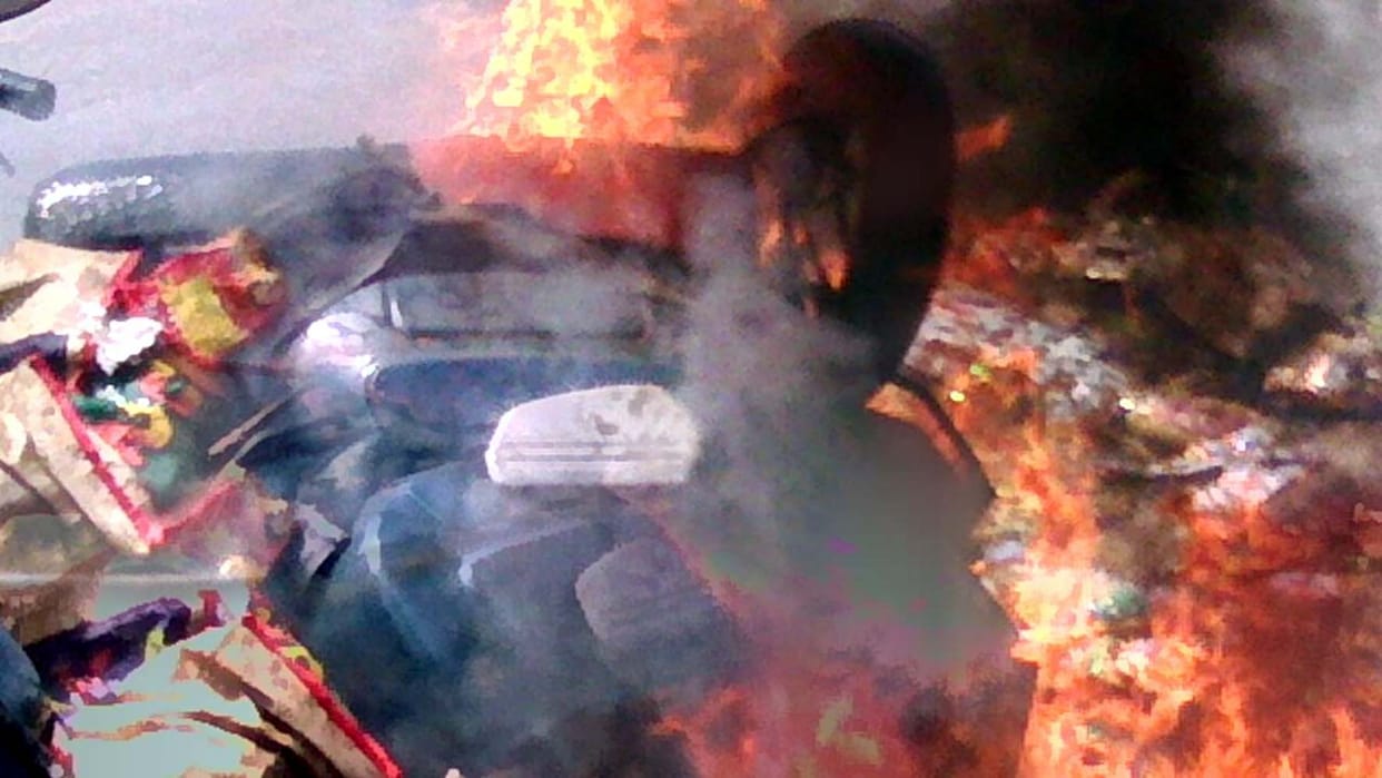 scooter burned in accident