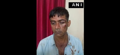 Two arrested in connection with the attack on the African citizens, cab driver looking at Raiders