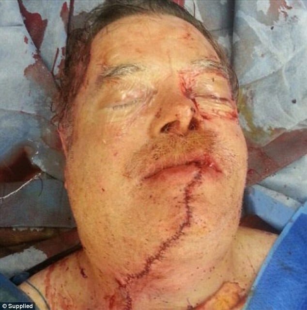 Grandfather, 68, who cut his face off with a chainsaw