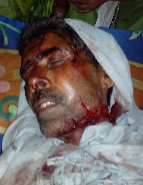 Farmer attacked by the tiger, serious