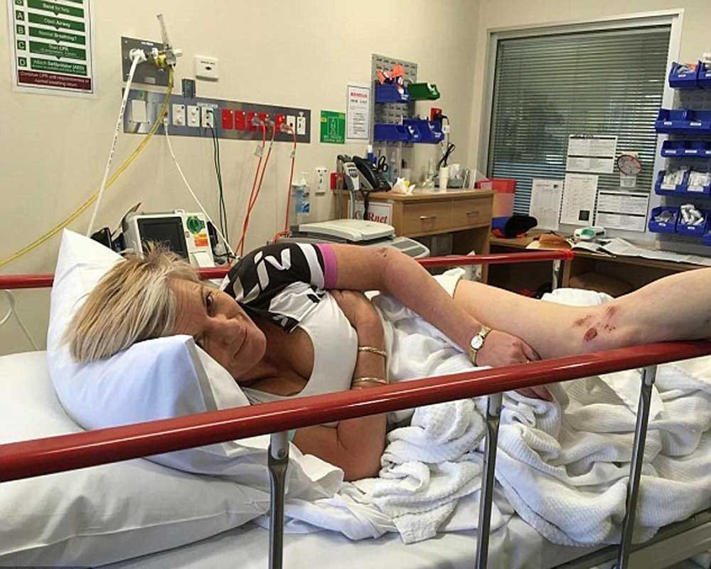 Kangaroo damages Australian woman's implanted breasts