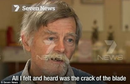 Grandfather, 68, who cut his face off with a chainsaw