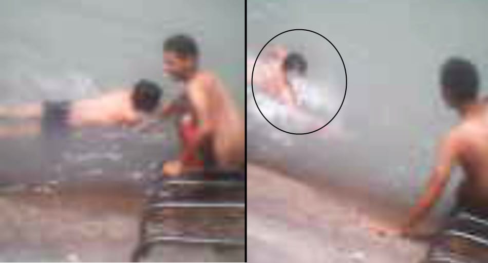 After bathing the young man's health deteriorated, death