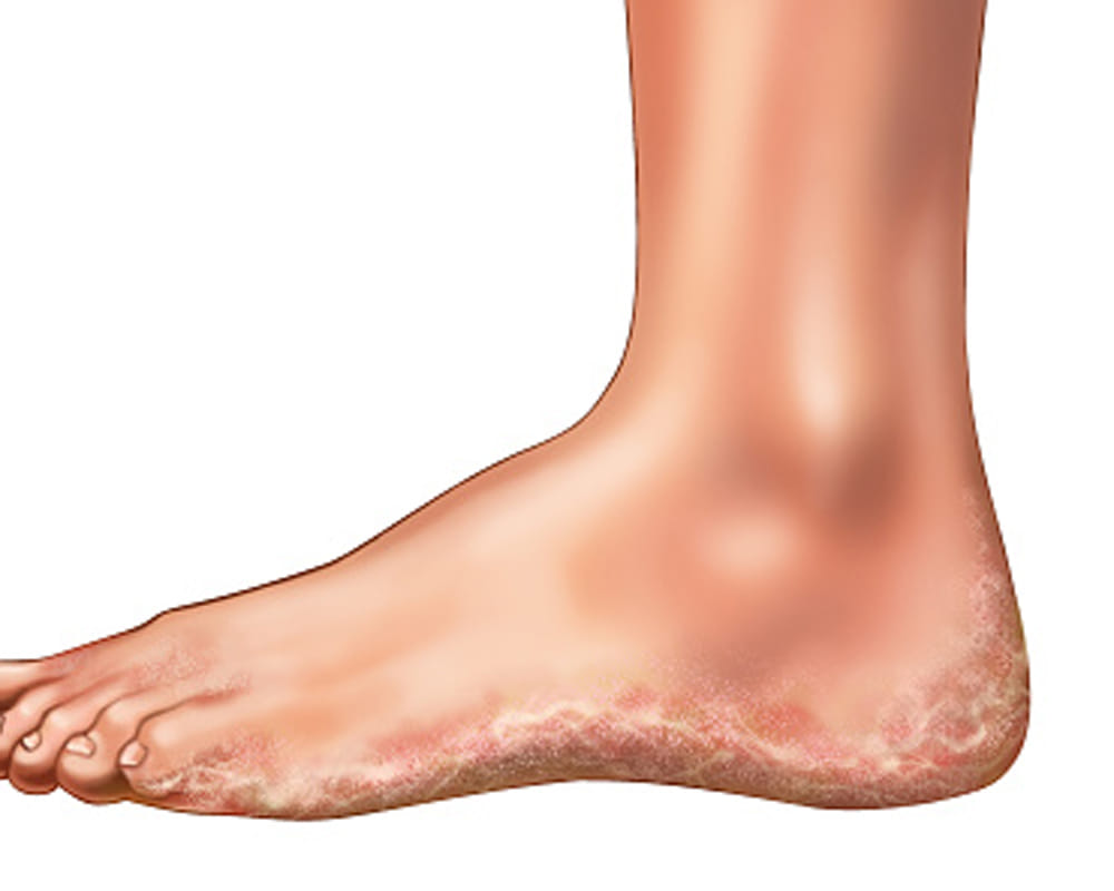  legs can reveal about your legs