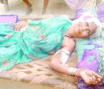 women wounded in leopard attacked