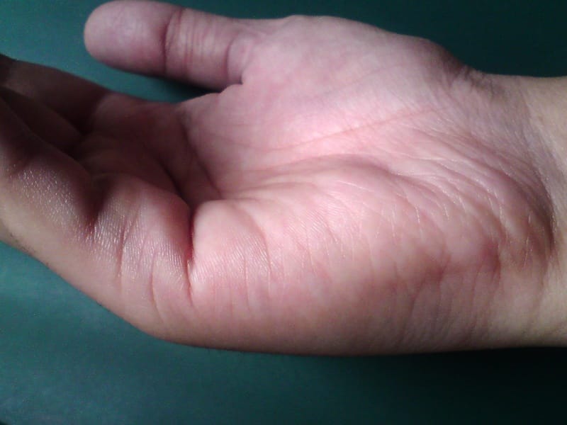 palmistry marriage line