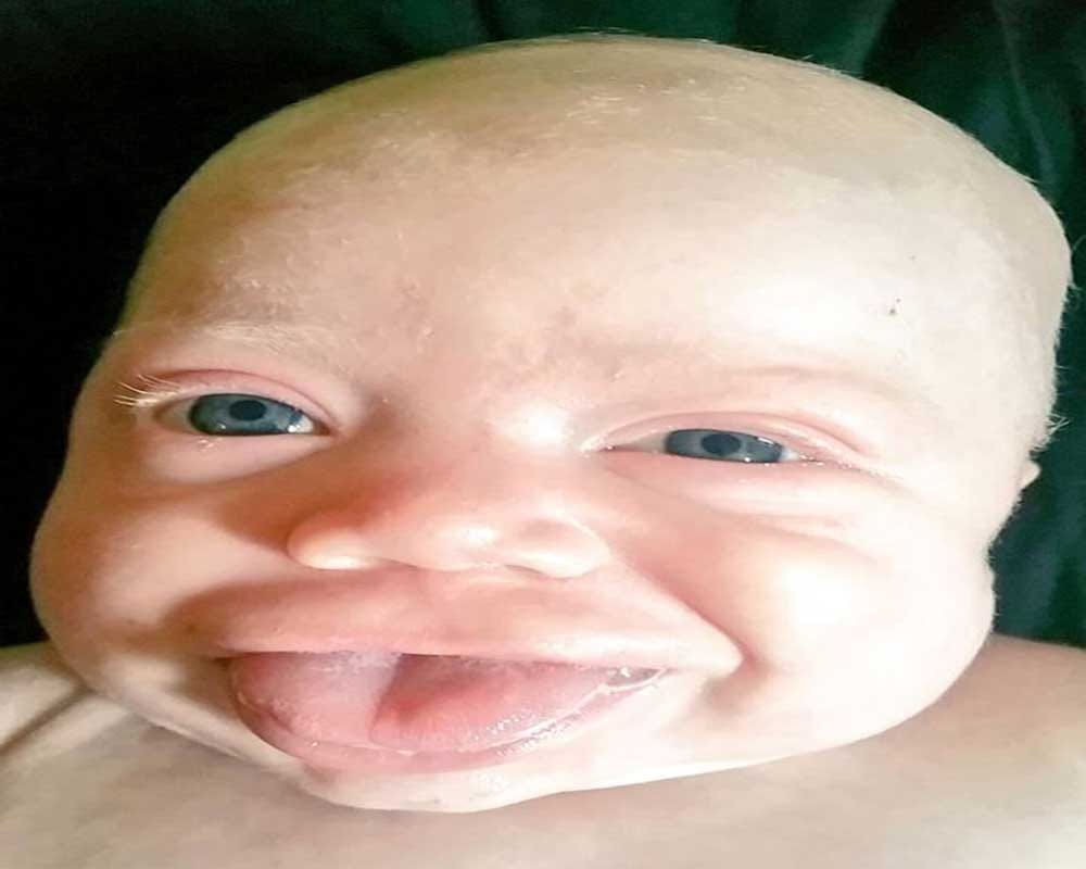 baby with 4 inches long tongue