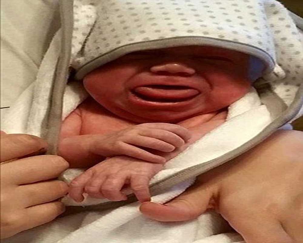 baby with 4 inches long tongue