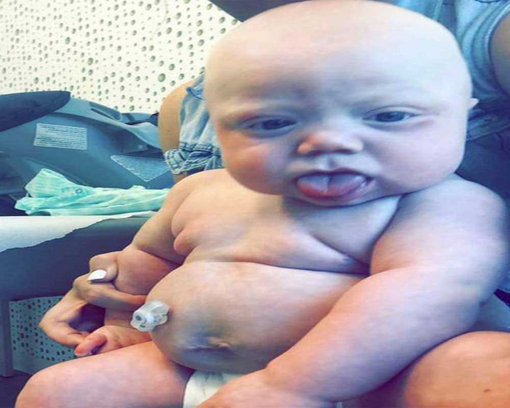 baby with 4 inches long tongue