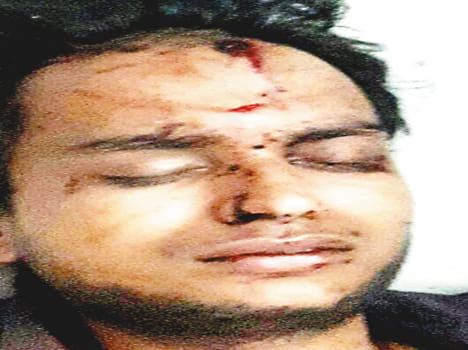 Youth injured laptop-cash looted