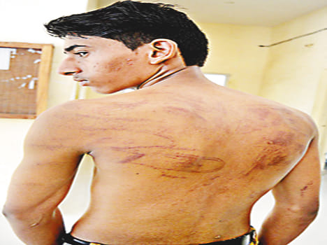 Beaten by moving from house arrest sought