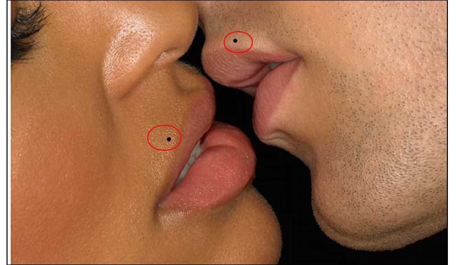 sex and mole on body