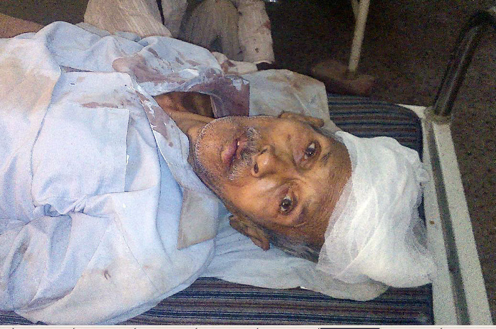 mathura jawahar bagh injured people