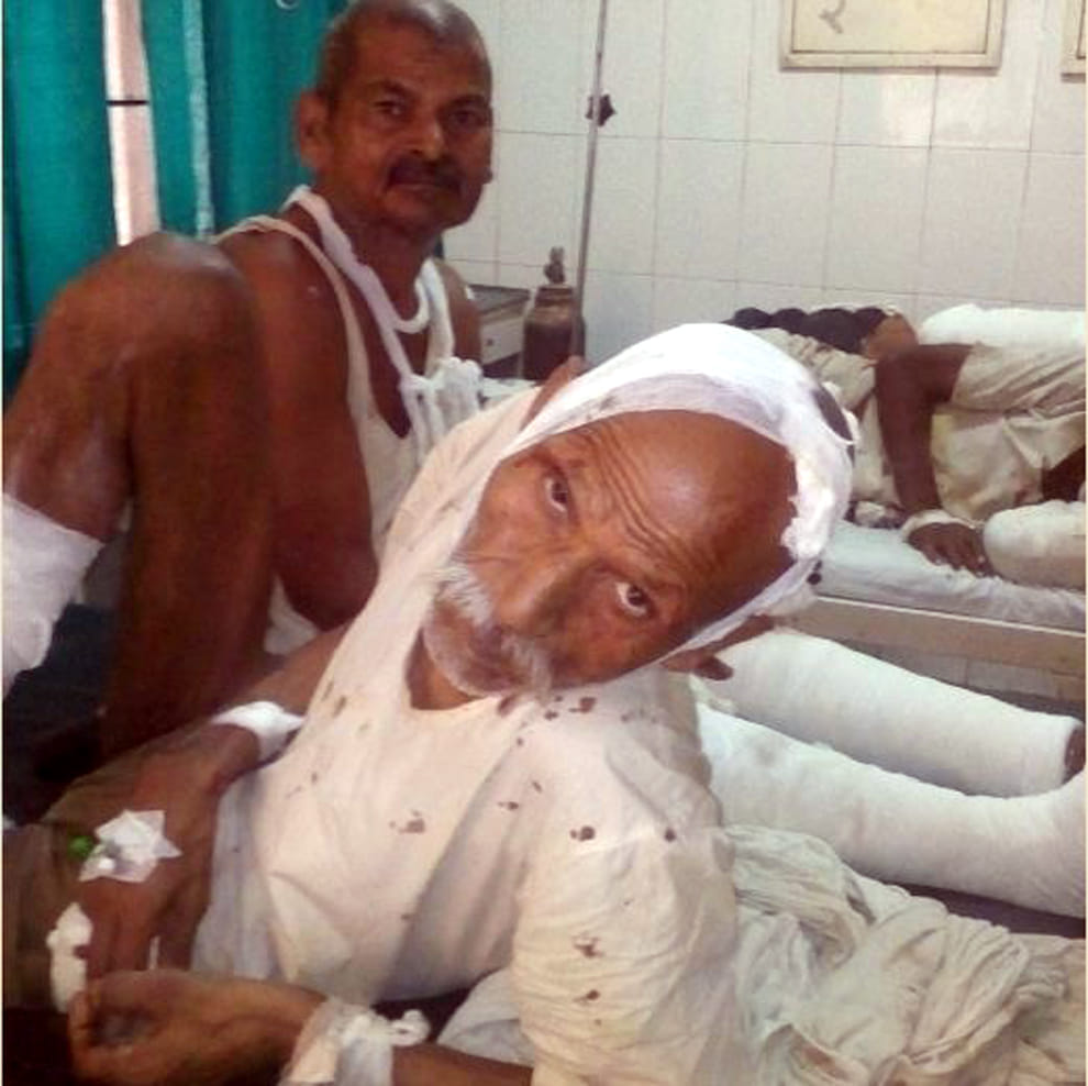 mathura jawahar bagh injured people