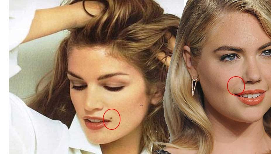 sex and mole on body