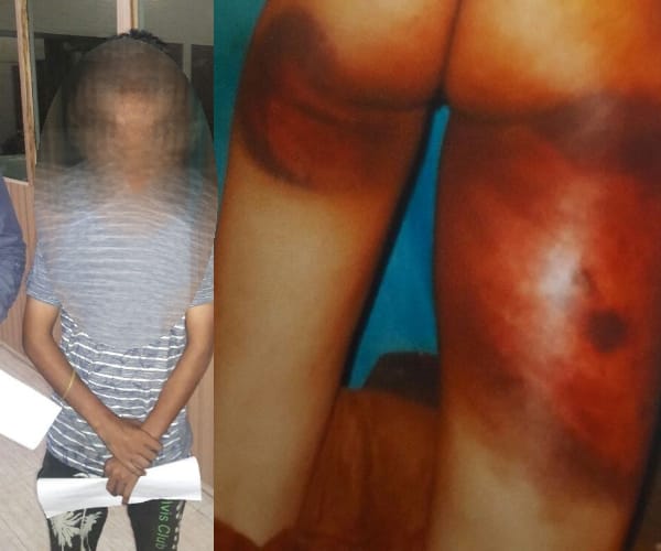 A teen aged boy brutally got beaten.