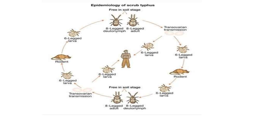 scrub typhus cases continue increasing in himachal