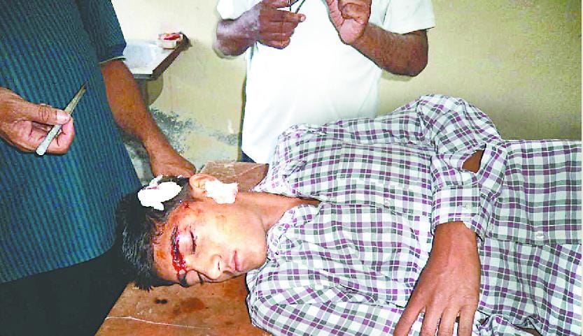 Fifteen-year-old boy in broad daylight slipped on Leopard