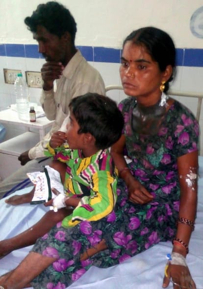 sky lightning in doiwala mining area, one died, 17 injured.