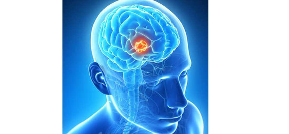 'Mental Viagra' injections made from CHOCOLATE