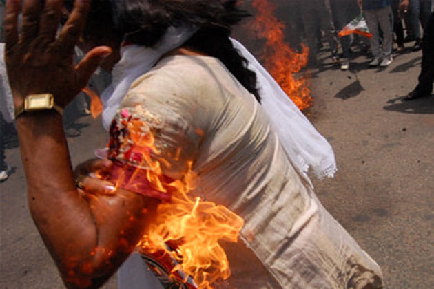 congress woman activist hand burnt while burning pm modi effigy