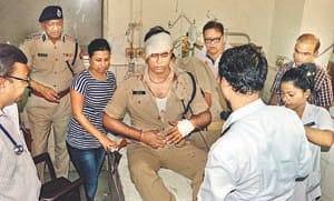 Placing the body organically , cracked head of IPS