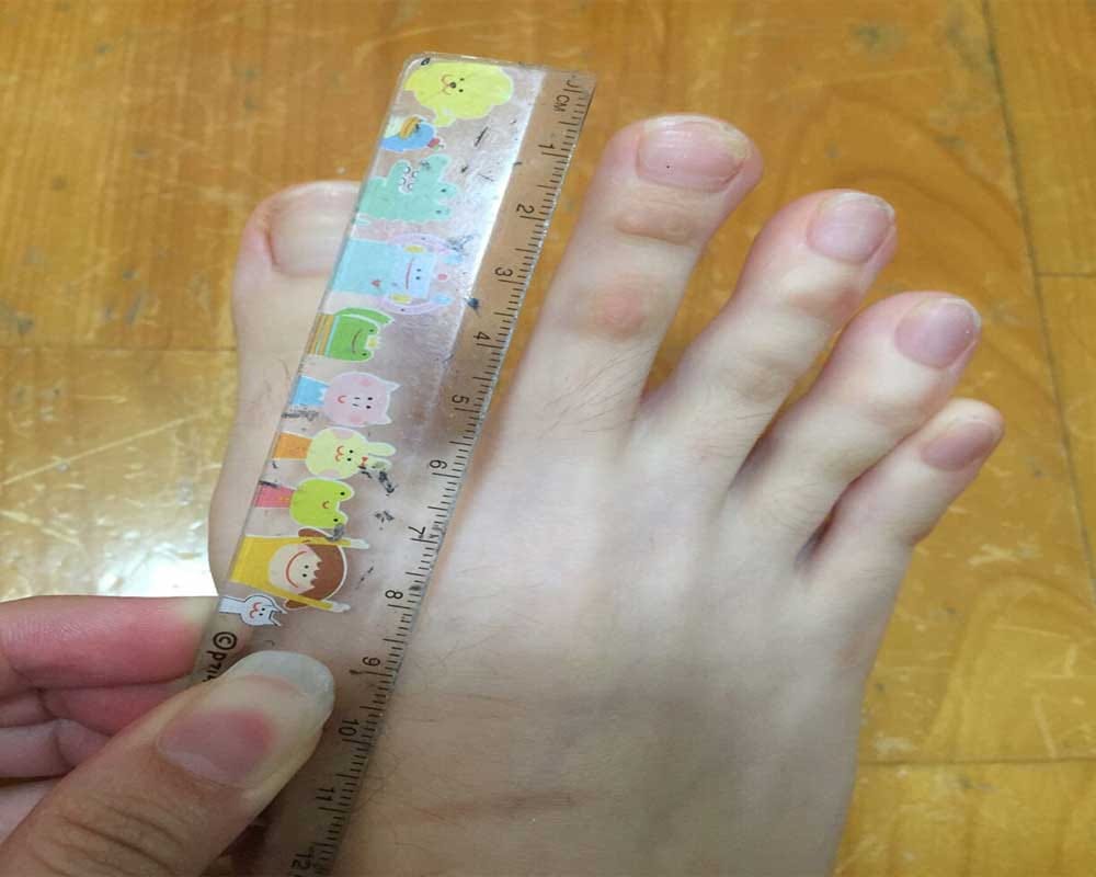  A Taiwanese student  shared pictures of her feet online