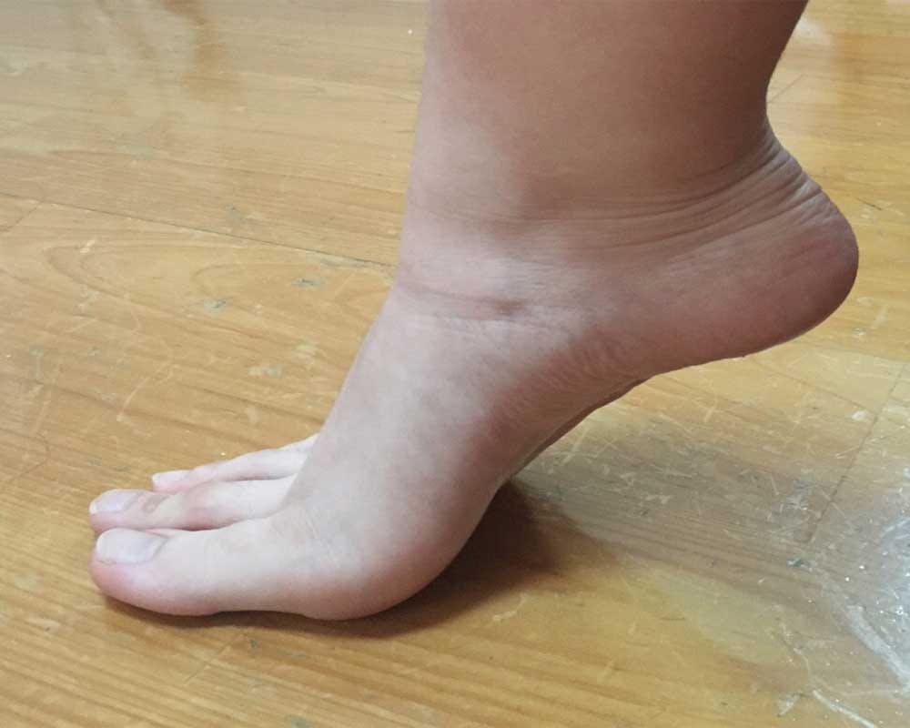  A Taiwanese student  shared pictures of her feet online