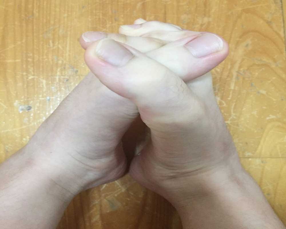  A Taiwanese student  shared pictures of her feet online