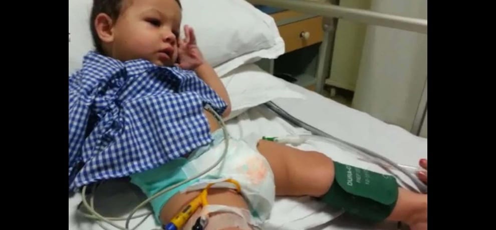 successful surgery of a rare eye dancing syndrome of one year old boy