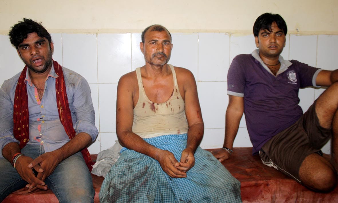 Seven injured in firing and stone pelting