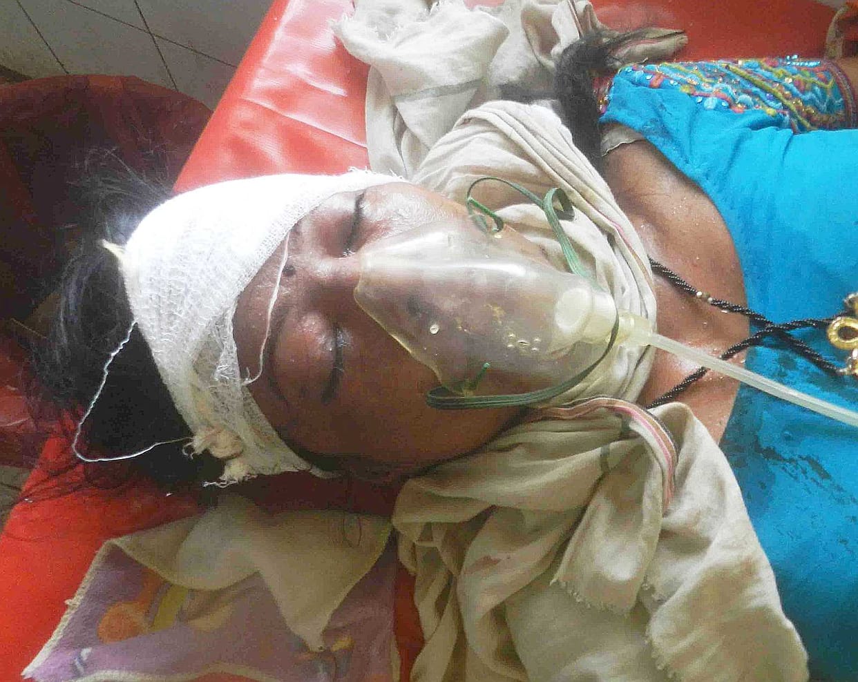 Women between two buses escaped serious