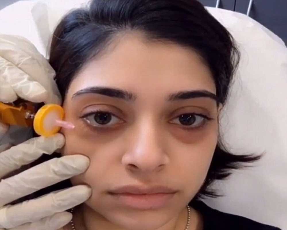 Woman injecting GAS under her eyes to remove to dark circlers 