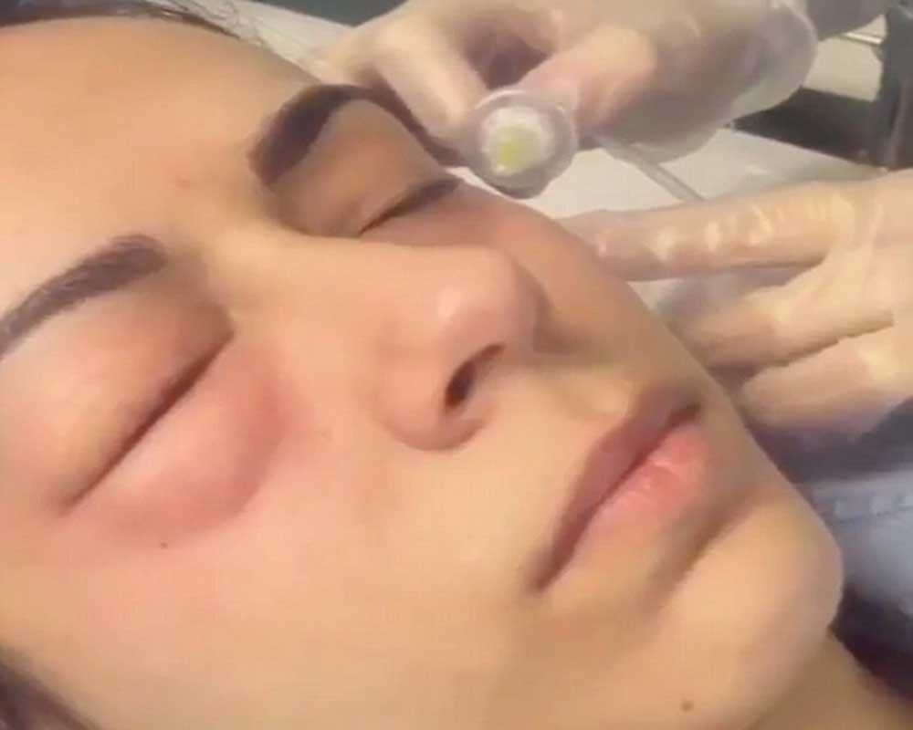 Woman injecting GAS under her eyes to remove to dark circlers 