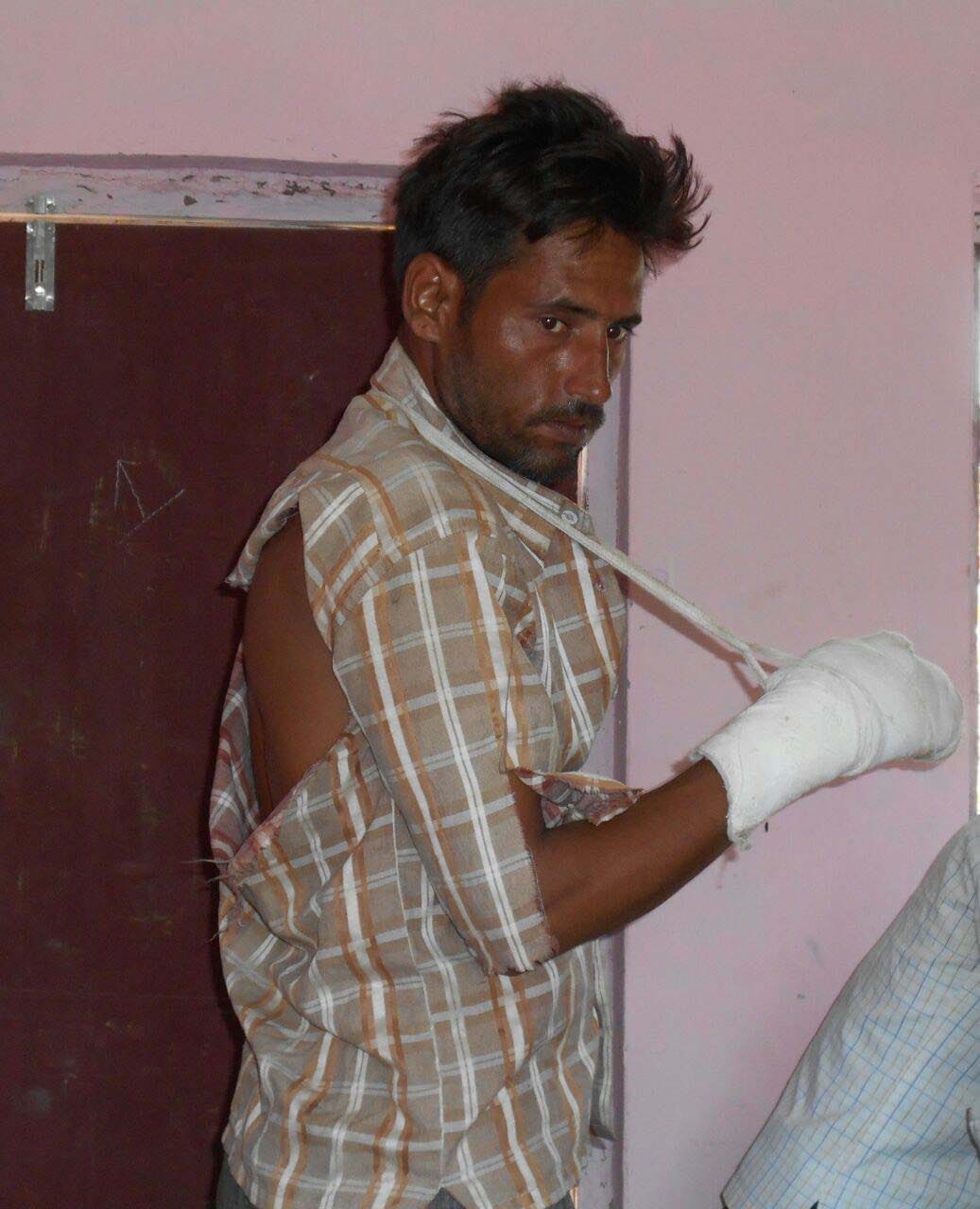 Kotedar from beating Cardholder injured