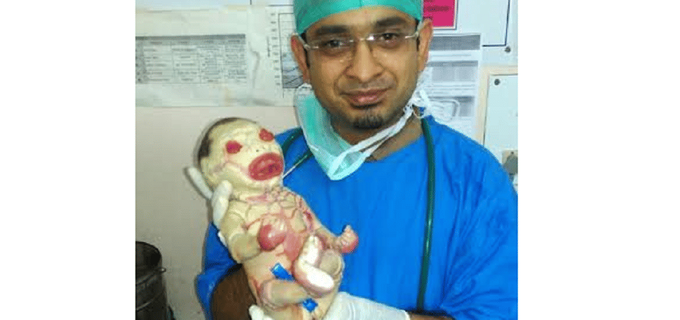 first herlequin babay born in ndia