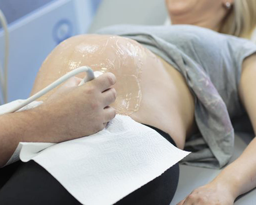 bizarre photo of ultrasound, fetus resembled to car