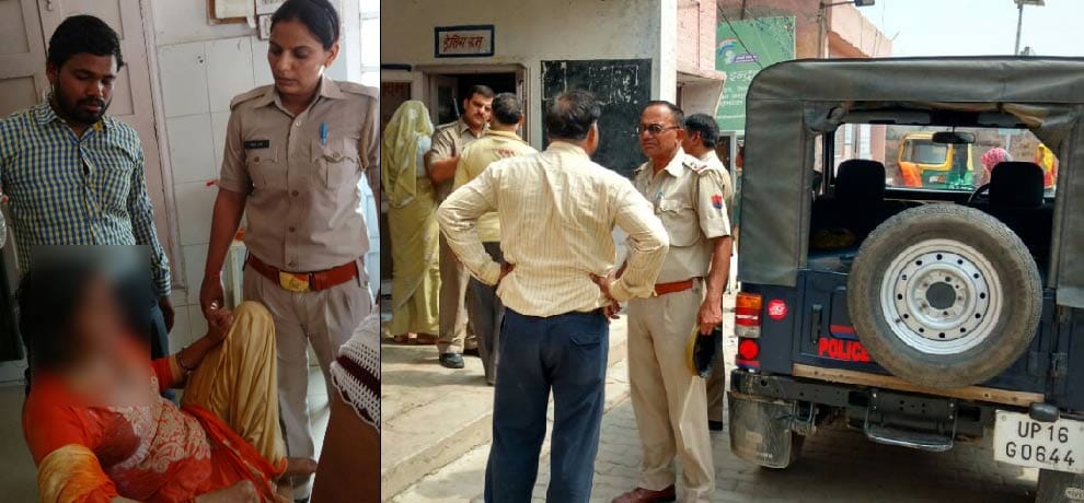 she denied to marry with him, crazy lover threw acid on her face
