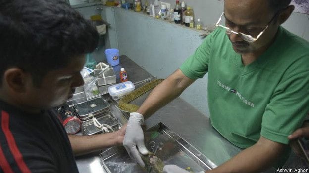 operation of snake in mumbai