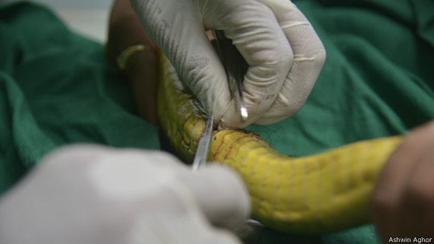 operation of snake in mumbai