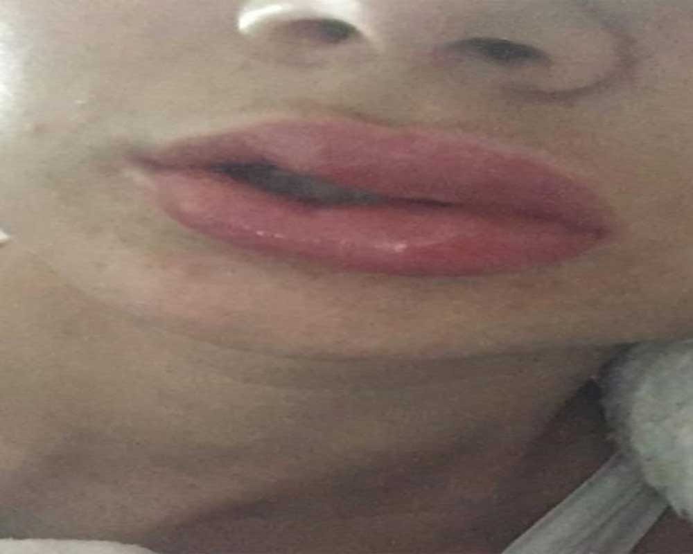 know whats your lips say about your life according to palmistry