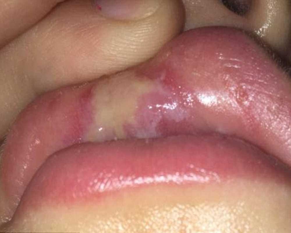 Cut lip and palate will be free operation
