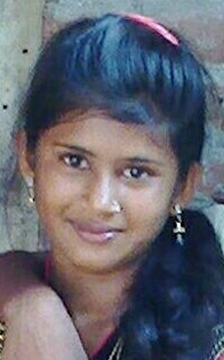 teenage girl died due to burn in suspecatable condition
