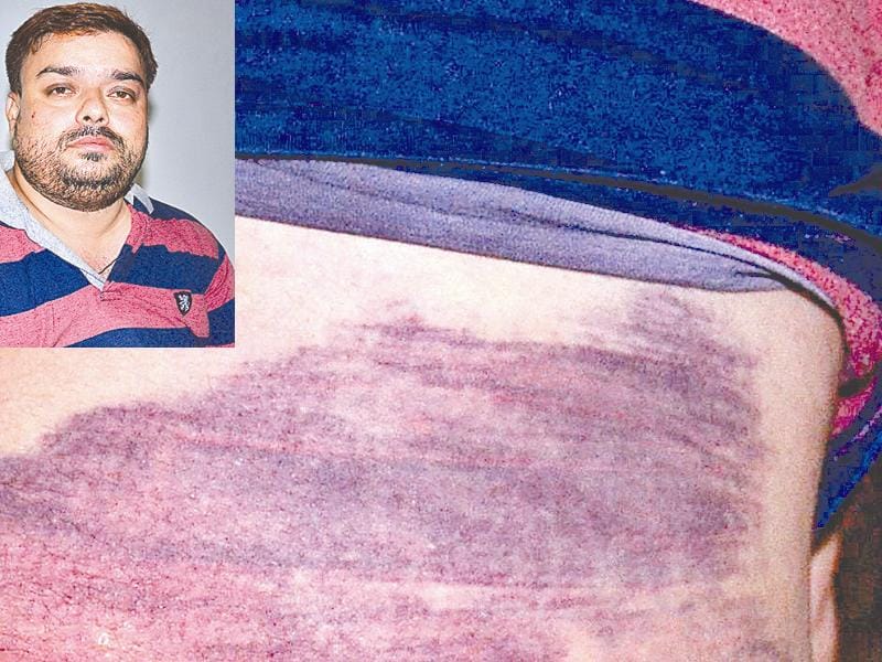 Traders beaten in custody