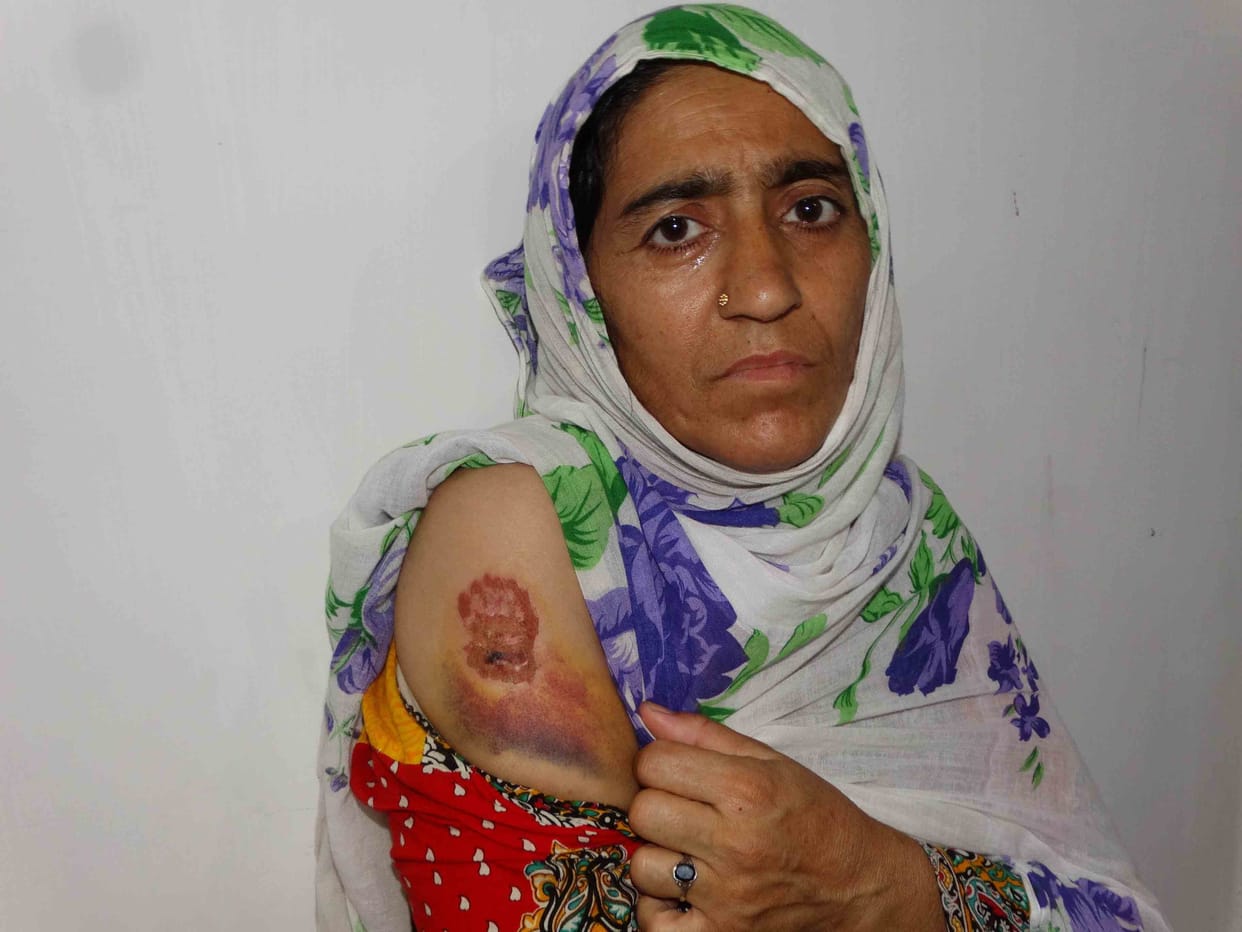 Over the years, is facing domestic violence Nasima