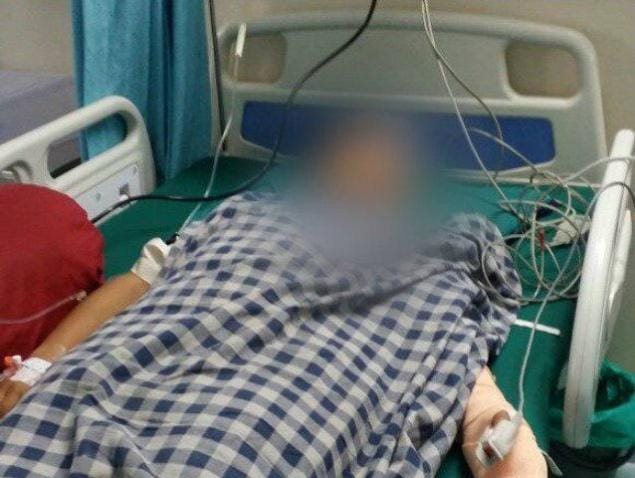 Acid attack on College teacher in Bhopal
